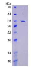 Human NEP / DDR1 Protein (Recombinant His, N-Terminal)