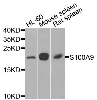 Polyclonal Rabbit anti-Human S100A9 / MRP14 Antibody (WB)