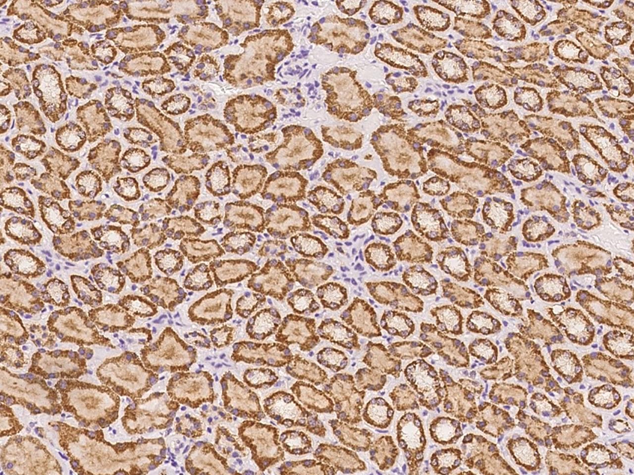 ABCB9 Antibody