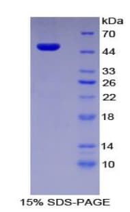 Human SERPINE1 / PAI-1 Protein (Recombinant His-S)