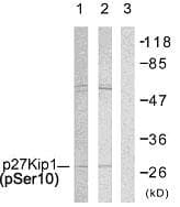 CDKN1B / p27 Kip1 Antibody (phospho-Ser10)