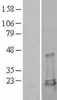 Human UBE2L3 / UBCH7 Protein (Over-Expression Lysate Myc-DDK (Flag))