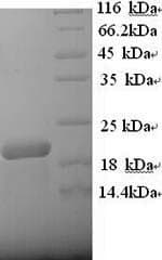 Human CD20 Protein (Recombinant 6His, N-terminus)