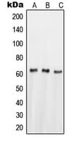 Polyclonal Rabbit anti-Human NR4A1 / NUR77 Antibody (Internal, IHC, WB)