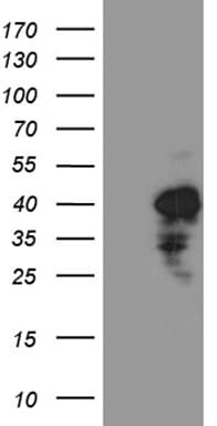 Monoclonal Mouse anti-Human CHIA / Amcase Antibody (clone OTI3G3, WB)
