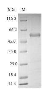 Human SEPHS1 / SPS Protein (Recombinant GST, N-terminus)