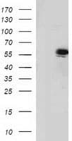 TP53 / p53 Antibody (clone OTI1D1)