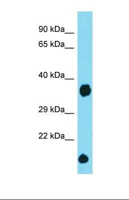 DCUN1D2 Antibody (N-Terminus)
