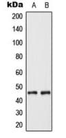 KRT18 / CK18 / Cytokeratin 18 Antibody (N-Terminus)