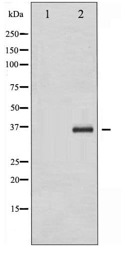 C/EBP Beta / CEBPB Antibody (phospho-Thr235/188)