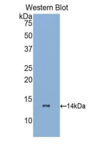 CSF3R / CD114 Antibody (aa26-138)