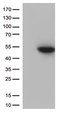 Monoclonal Mouse anti-Human CDK15 / ALS2CR7 Antibody (clone OTI4H2, Carrier-free, aa293-378, WB)