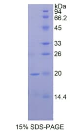 Mouse THBS1 / Thrombospondin-1 Protein (Recombinant His)
