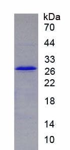 Human MMP25 / Leukolysin Protein (Recombinant His, N-Terminal)