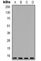 EIF4EBP1 / 4EBP1 Antibody (N-Terminus)