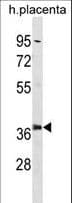 Polyclonal Rabbit anti-Human PSMD6 Antibody (aa154-182, WB)