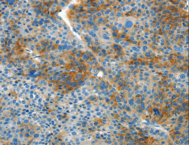 Polyclonal Rabbit anti-Human L1CAM Antibody (IHC)