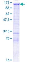 Human EPB41L3 Protein (Recombinant GST)