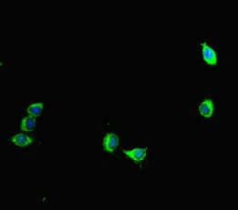 AURKA / Aurora-A Antibody (aa1-131)