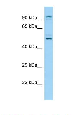 KDM1B Antibody (aa67-116)