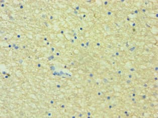 Polyclonal Rabbit anti-Human HTR2B / 5-HT2B Receptor Antibody (IHC)