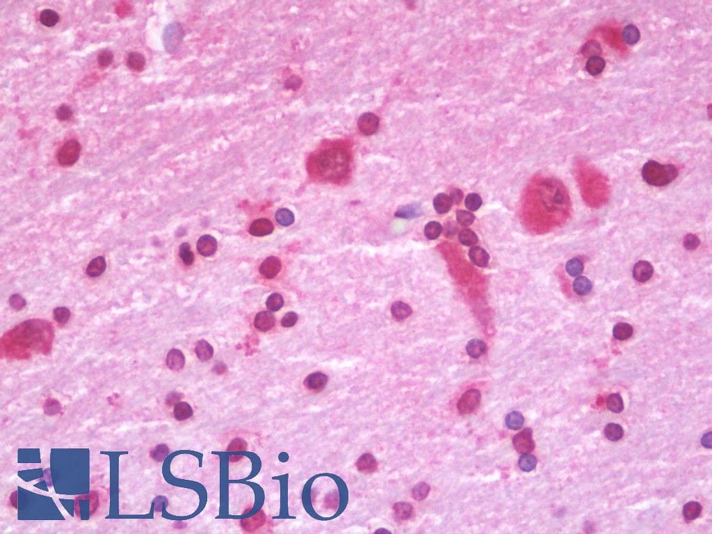 IHC-plus™ GRM1 / MGLUR1 Antibody (clone 1F7)