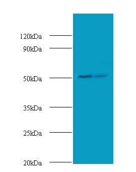 AP50 / AP2M1 Antibody