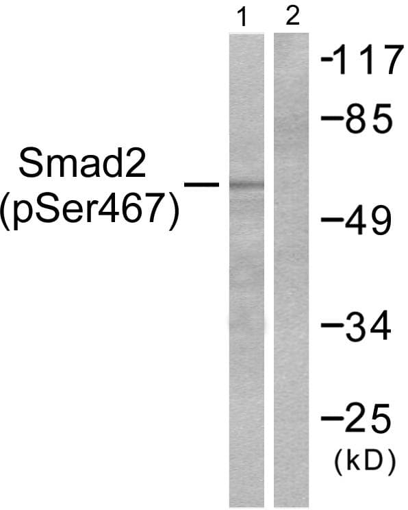 SMAD2 Antibody (p467)
