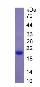 Human PRDX5 / Peroxiredoxin 5 Protein (Recombinant His)