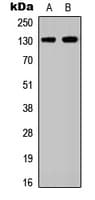 Polyclonal Rabbit anti-Human EPHA2 / EPH Receptor A2 Antibody (N-Terminus, WB)