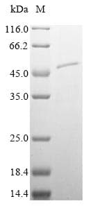 Mouse SERPINA5 / PCI Protein (Recombinant 10His, N-terminus)