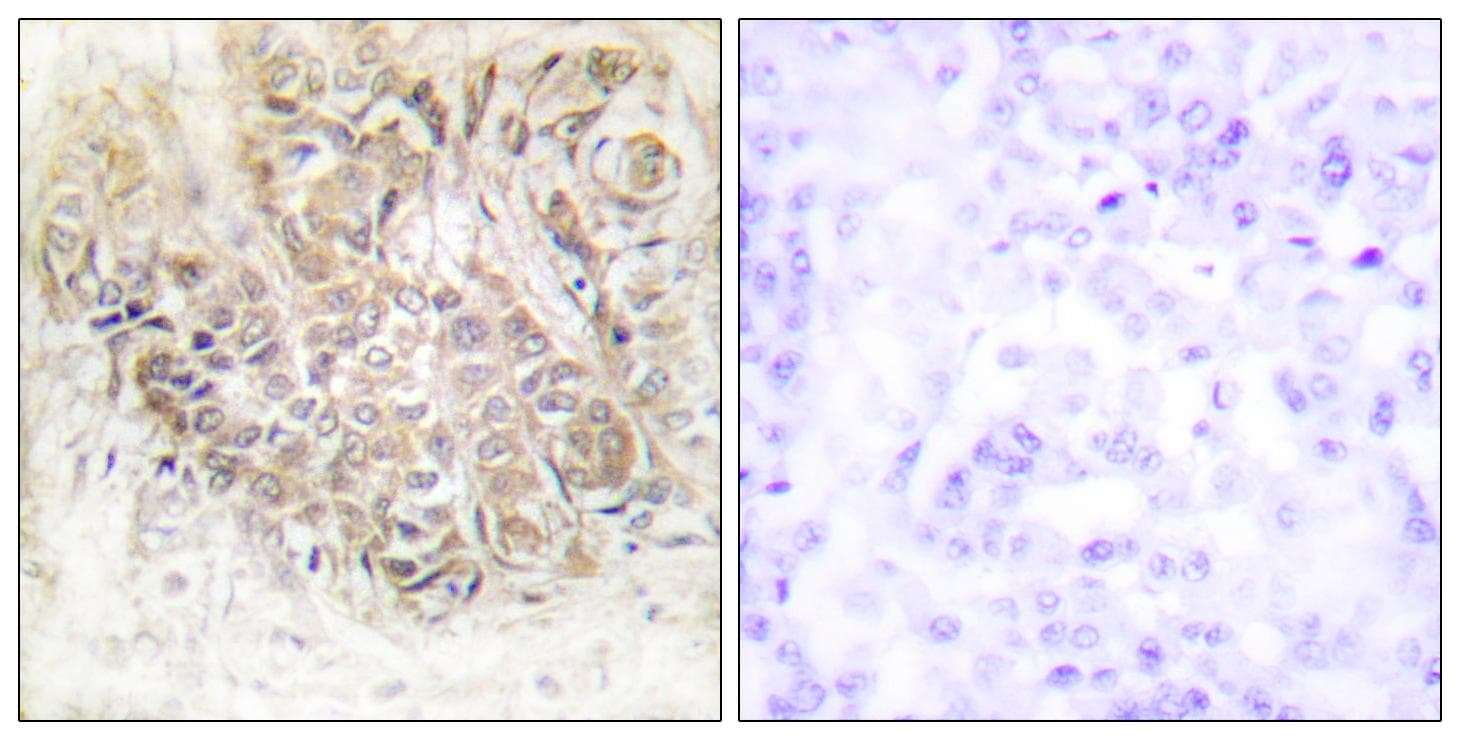 Polyclonal Rabbit anti-Human TPT1 / TCTP Antibody (IHC, WB)