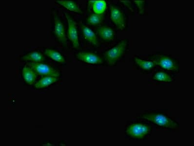 PCGF2 / MEL-18 Antibody