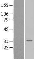 CENPP Protein (Over-Expression Lysate Myc-DDK (Flag))