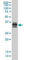 ST3GAL2 Antibody (clone 1E12)