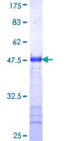 Human GOLM1 / GP73 / GOLPH2 Protein (Recombinant GST, N-terminus)