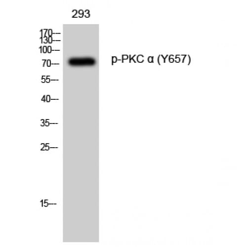 PRKCA / PKC-Alpha Antibody (600-680 aa)