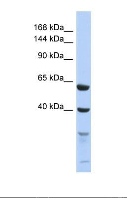 TEX11 Antibody (aa218-267)