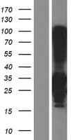 C4BPB / C4BP Beta Protein (Over-Expression Lysate Myc-DDK (Flag))
