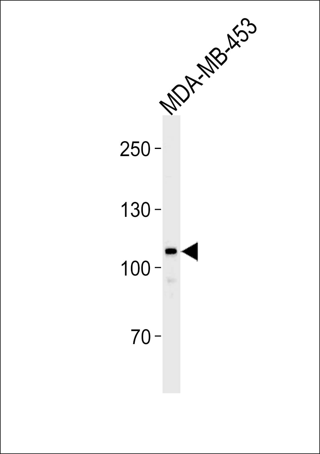 GEN1 Antibody (aa60-89)