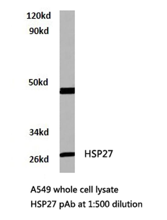 HSPB1 / HSP27 Antibody