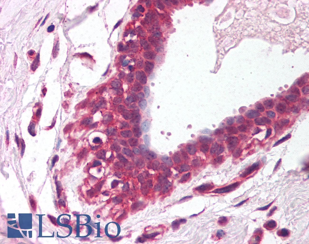 Polyclonal Rabbit anti-Human PEA3 / ETV4 Antibody (aa181-230, IHC, WB)