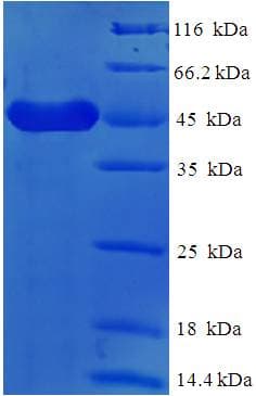 Human FCER2 / CD23 Protein (Recombinant His-SUMO)