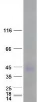 Human CEACAM7 Protein (Recombinant Myc-DDK (Flag))