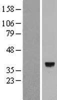 CAMKMT Protein (Over-Expression Lysate Myc-DDK (Flag))