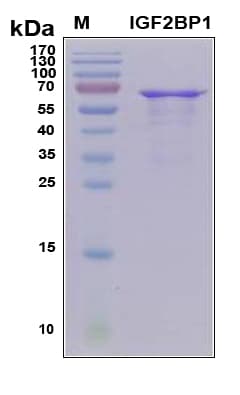Human IGF2BP2 Protein (Recombinant 6His, N-terminus)