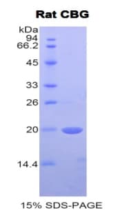 Rat SERPINA6 / CBG Protein (Recombinant His)