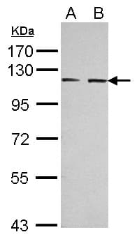 EPHA3 / EPH Receptor A3 Antibody