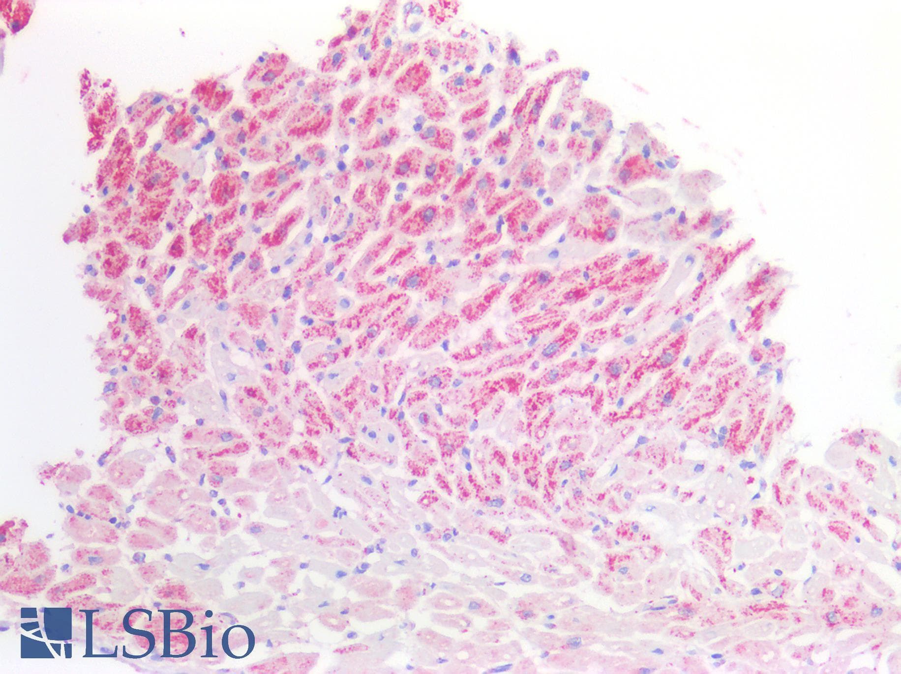 IHC-plus™ Polyclonal Goat anti-Human MDH / MDH2 Antibody (Internal Region, IHC, WB)