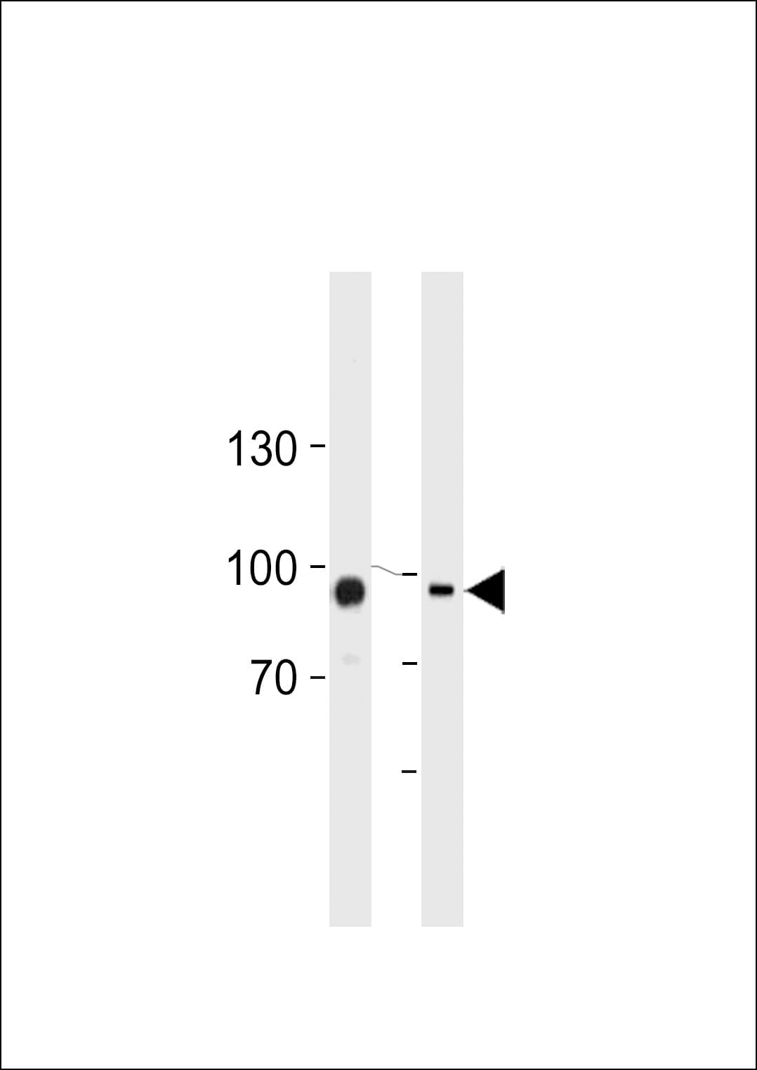 Polyclonal Rabbit anti-Human TGM2 / Transglutaminase 2 Antibody (Lys444, IHC, IF, WB)